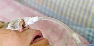 Feeding Tube