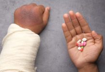 Workers' Compensation Benefits