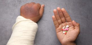 Workers' Compensation Benefits