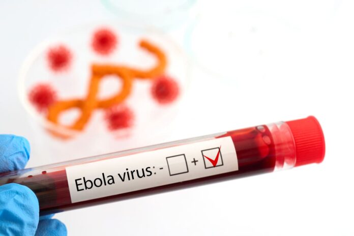 iStock-2279919221 (1) Ebola Crisis