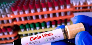 The Ebola Escalation is a Global Health Emergency Blood sample for Ebola virus test to identify viral hemorrhagic fever.