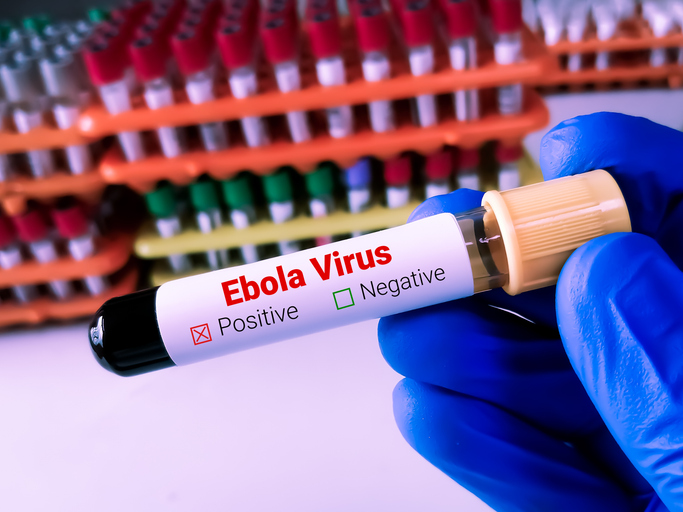 Blood sample for Ebola virus test to identify viral hemorrhagic fever. Life threatening viral disease. Blood sample for Ebola virus test to identify viral hemorrhagic fever.