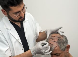 Hair Transplant Turkey - hair transplant surgery