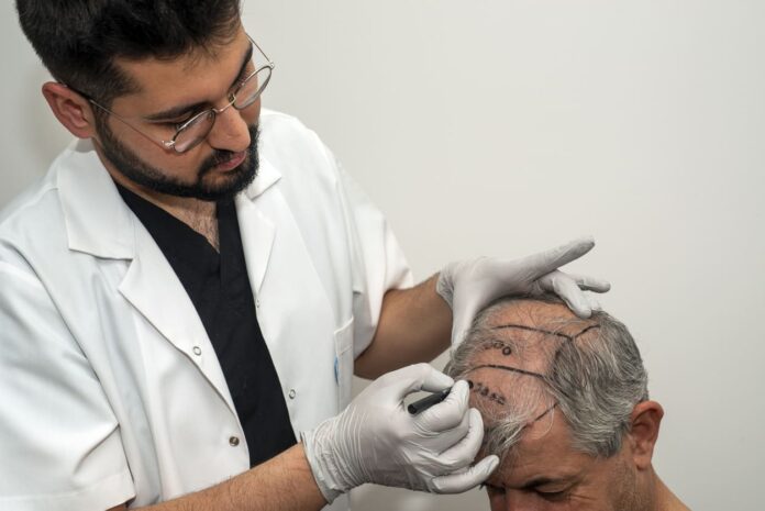 iStock-1391319833 (1) Hair Transplant Turkey - hair transplant surgery